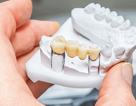Prosthodontic services in Hervey Bay qld