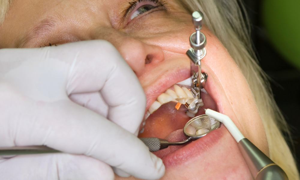emergency dental filling hervey bay